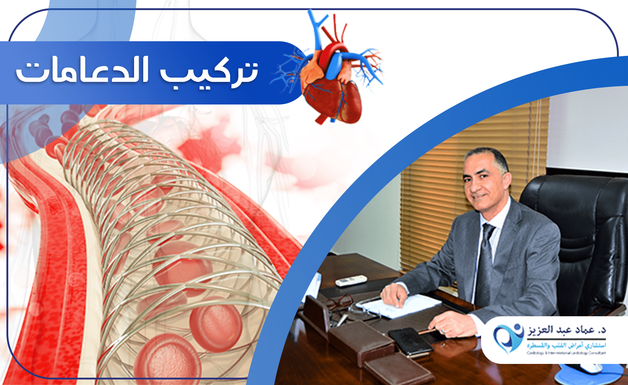 تركيب الدعامات